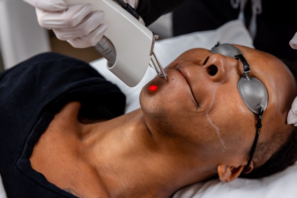 Evolution of Laser Hair Removal